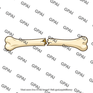 Bone fractured