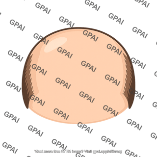 Top of head