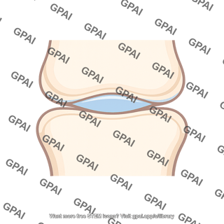 Knuckle cavity