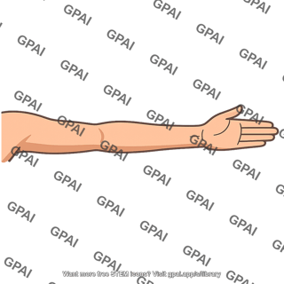 Arm outstretched