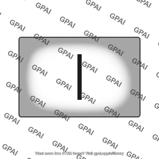 Screen with slit