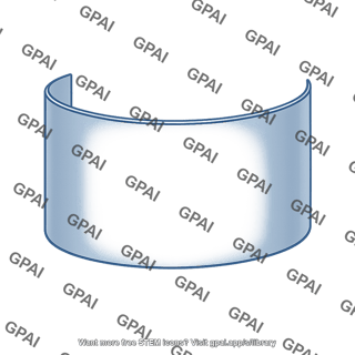 Cylindrical surface side