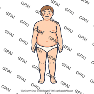 Cushing syndrome