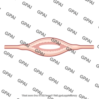 Ampulla of vas deferens