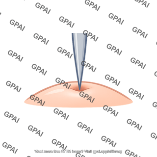 Single point stimulus on skin