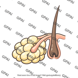 Sebaceous gland enlarged
