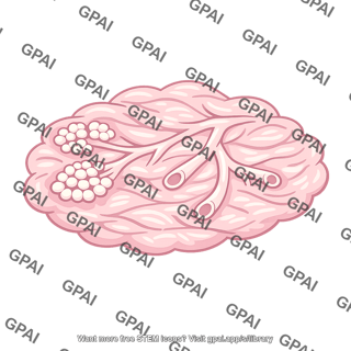 Stroma breast