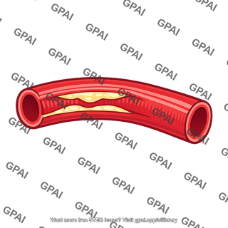 Artery with plaque