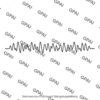 Ventricular fibrillation ecg