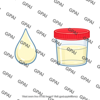 Urine dilute