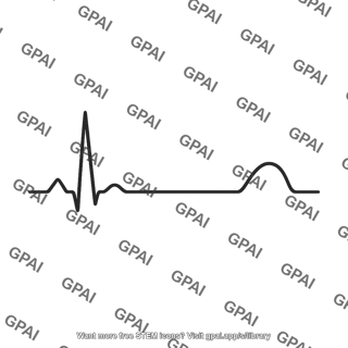 Ecg waveform