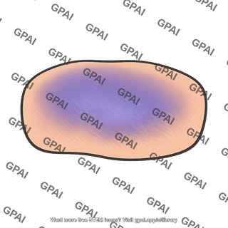 Skin cyanotic