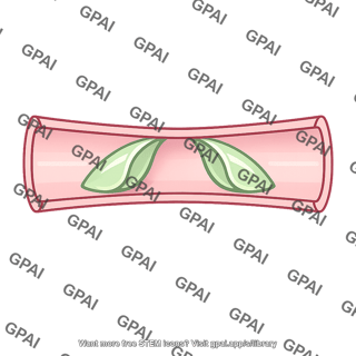 Vascular flap valve
