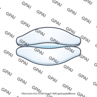 Joint cavity
