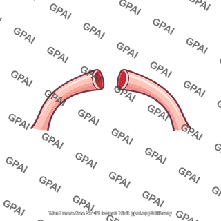 Pituitary stalk cut