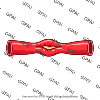 Renal artery stenosis