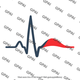 Premature ventricular contraction qrs t complex