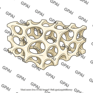 Trabecular bone