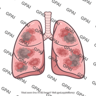 Lung diseased