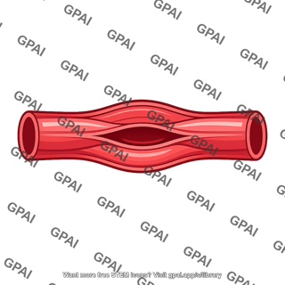 Vasoconstricted blood vessel