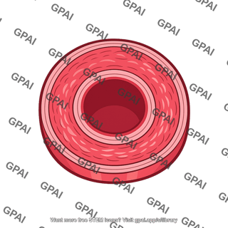 Artery hypertrophic remodeled