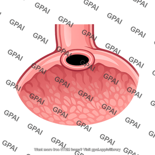 Esophageal opening