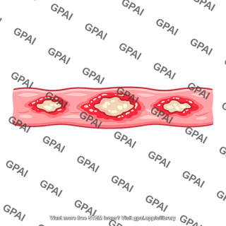 Esophageal mucosa ulcerated