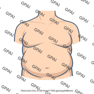 Fat deposition thoracic upper abdominal