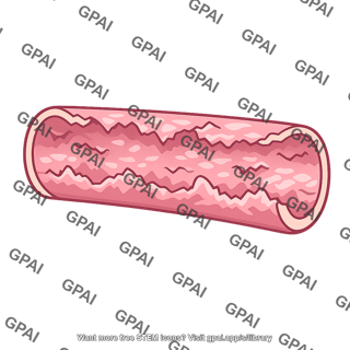 Endothelial surface roughened