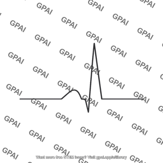 Q wave