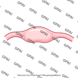 Ampulla of fallopian tube