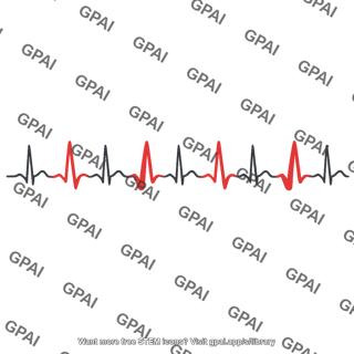 Premature ventricular contraction bigeminy
