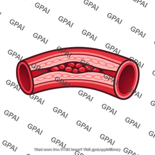 Hypertension artery