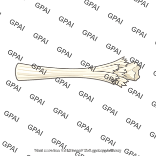 Tendon avulsed