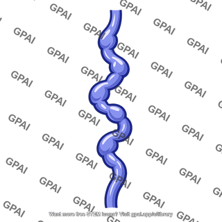 Vein varicose
