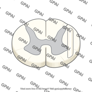 Anterolateral column