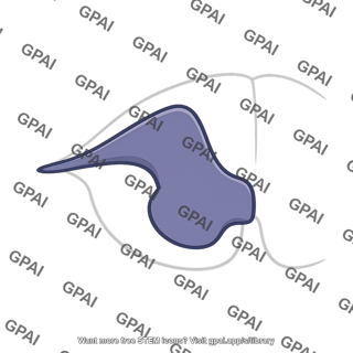Dorsal horn