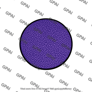 Primary nodule