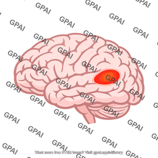 Language perception area