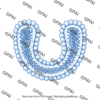 Small vesicle stage 4