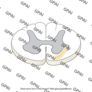Ventral spinothalamic tract