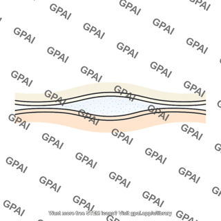 Synaptic cleft