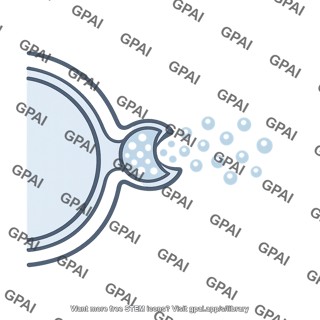 Cortical granule released