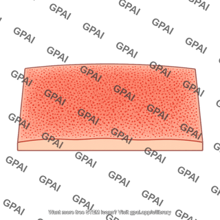 Scarlet fever rash