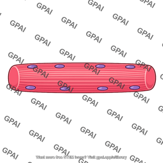 Skeletal muscle fiber longitudinally striated variant