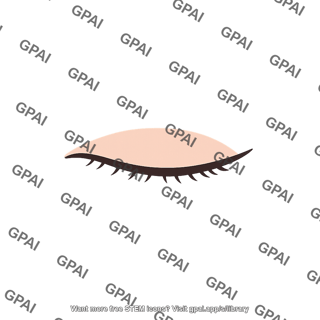 Closed eyelid