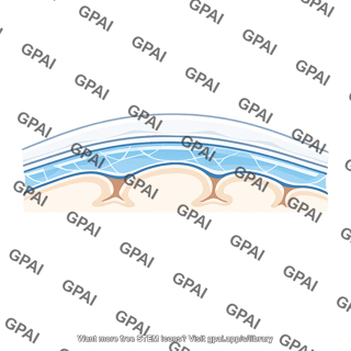 Subarachnoid space