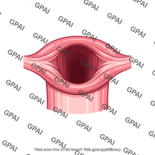 Upper esophageal sphincter open