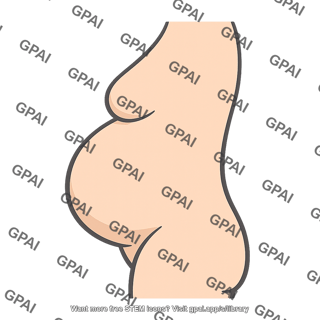 Pregnant abdomen