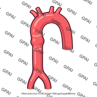 Coarctation of the aorta